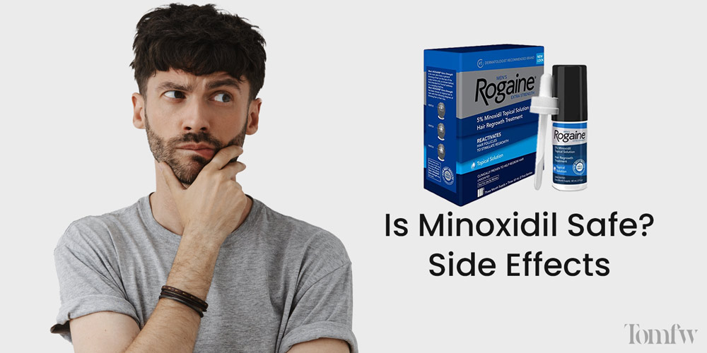 minoxidil beard side effects
