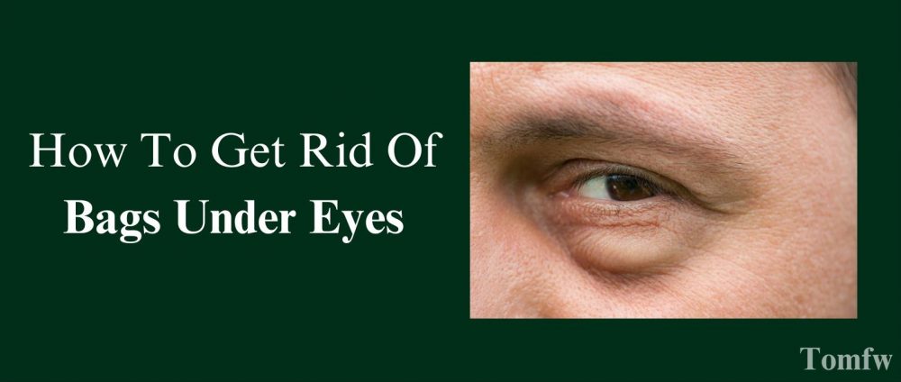 how to get rid of bags under eyes for men